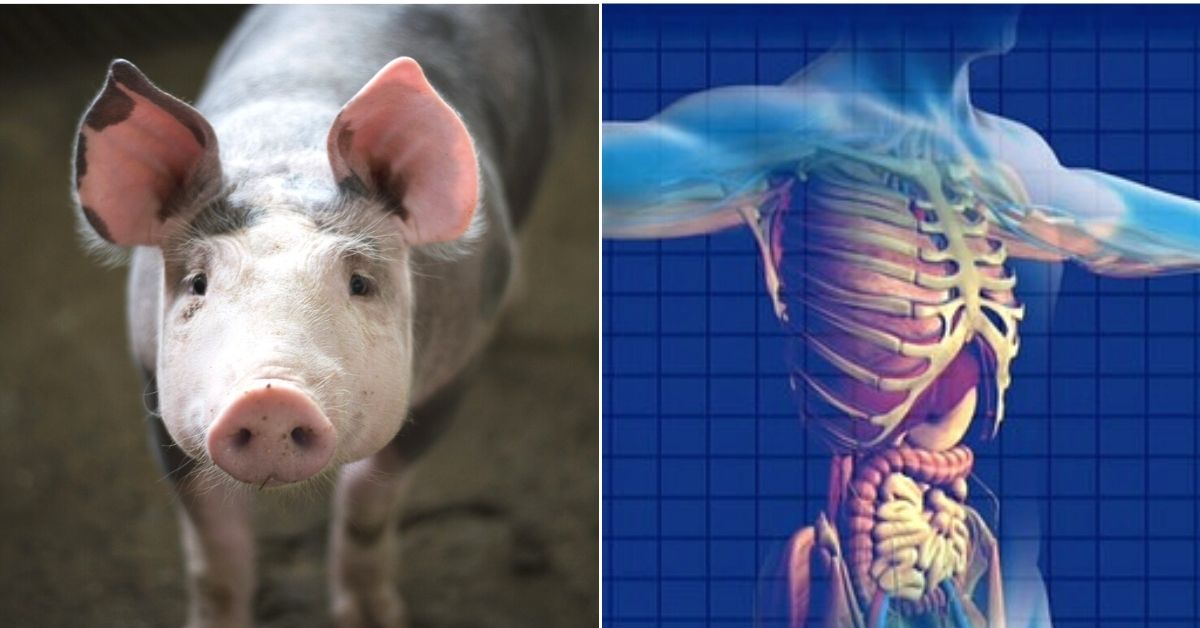 Histórico Trasplante de Riñones de Cerdo a Humano: Un Avance Revolucionario en la Ciencia Médica